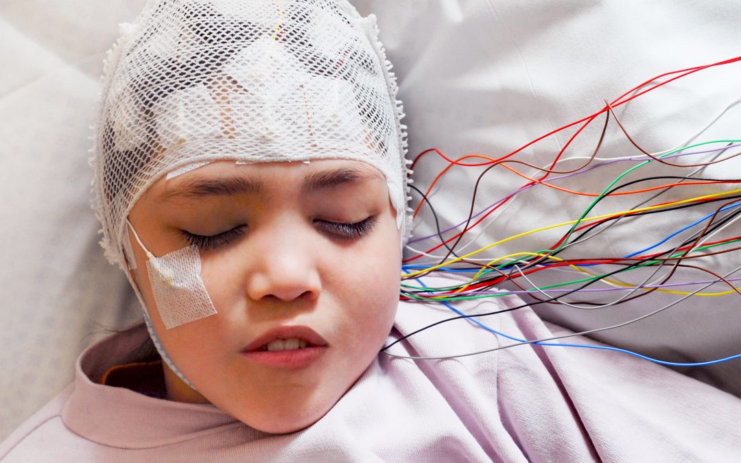 Refractory Seizures or Uncontrolled Epilepsy: Diagnosis and Treatment