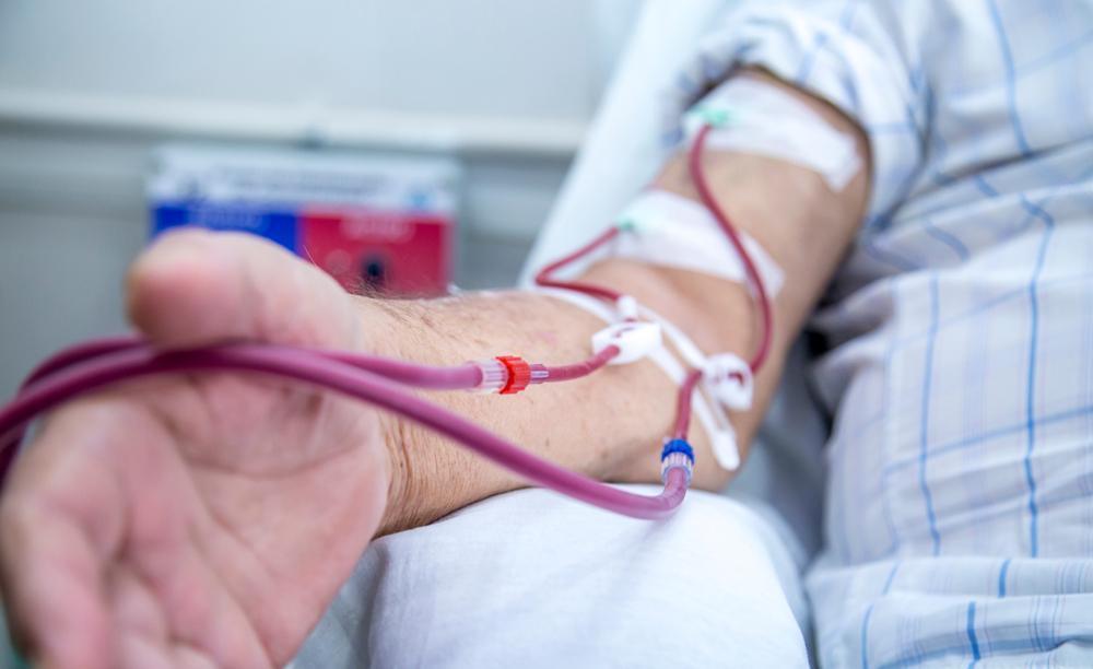 Treating chronic kidney disease through Hemodialysis or Peritoneal Dialysis