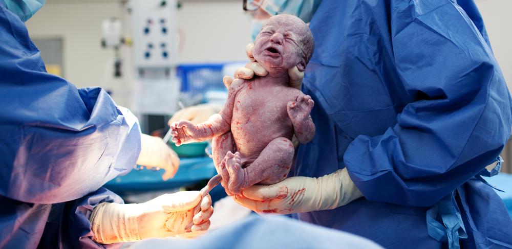 Can swabbing babies with mother’s vaginal bacteria affect their later health