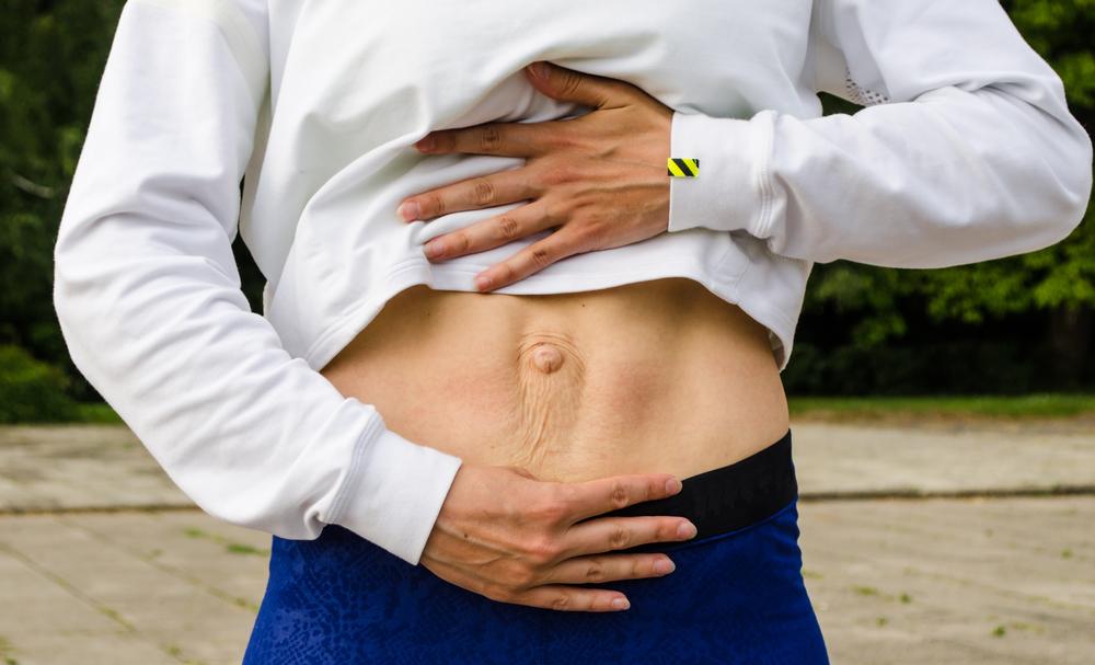 Diastasis recti abdominis in men and women