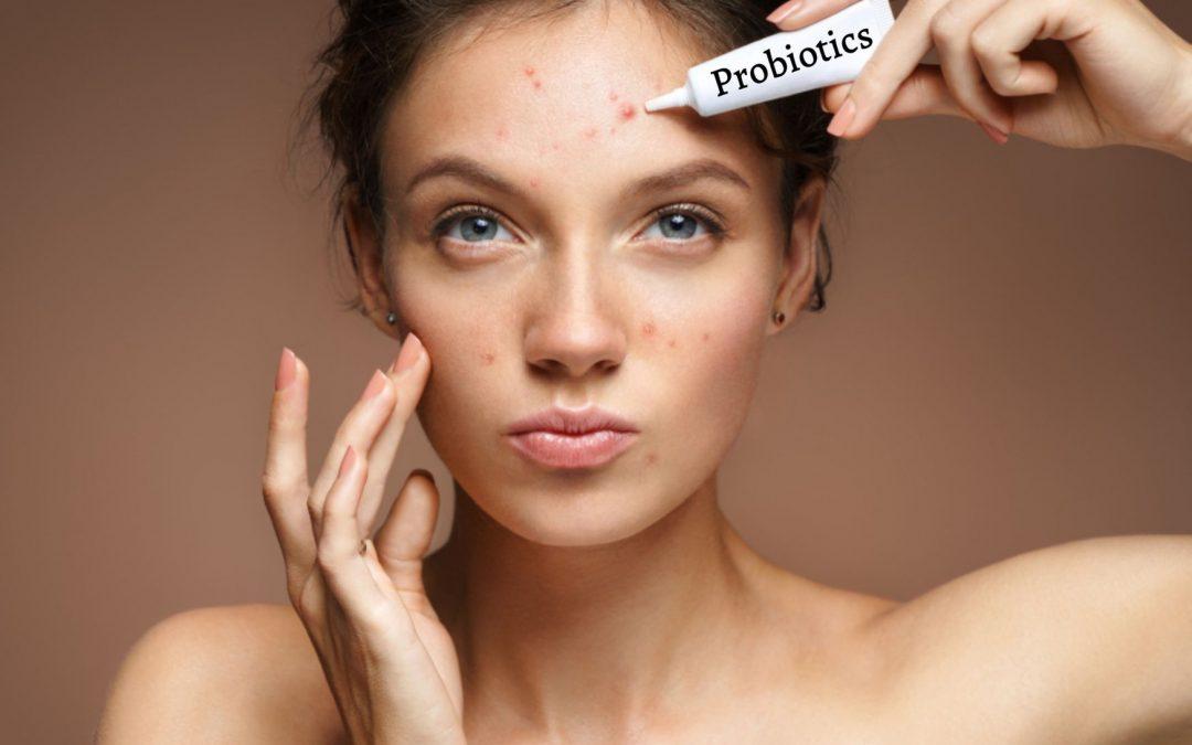 How Probiotics can fight acne and improve gut health