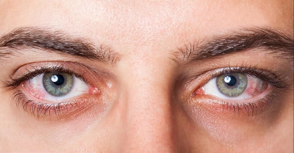 Can glaucoma therapies be balanced with ocular surface health?
