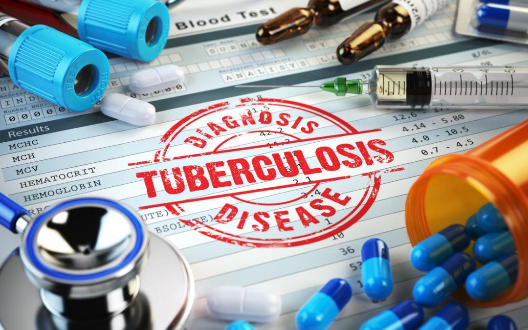 Sudden focus on COVID-19 has had a significant negative impact on TB
