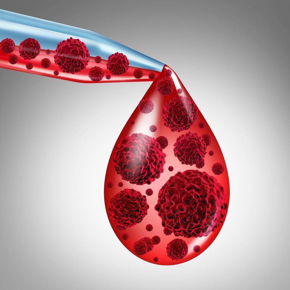 World Lymphoma Awareness Day : Let’s Protect Those at Risk Of Infections