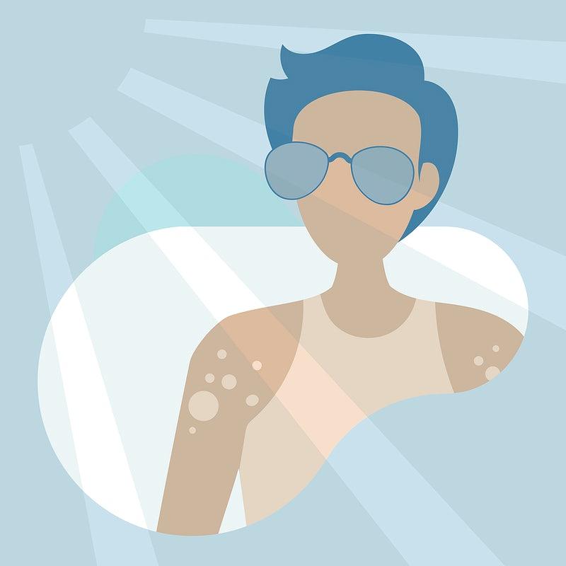 Skin Cancer Awareness Month :Keeping your skin safe