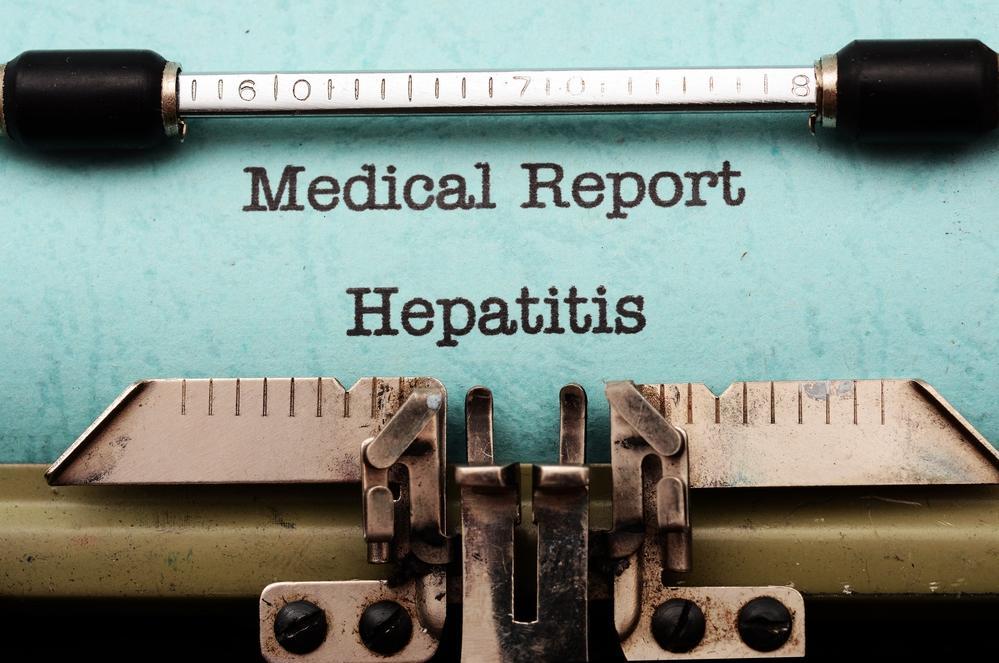 What is the role of hepatologist in the treatment of alcoholic hepatitis?