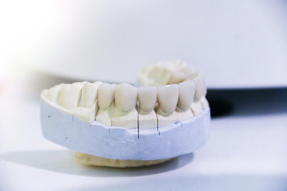 Dental 3D printing: how does it impact the dental industry