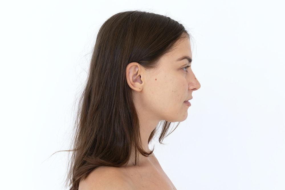 How to Treat a Perforated Ear Drum