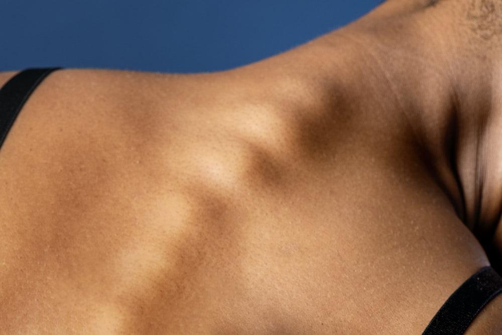 What is spinal anesthesia, and how is it different from epidural anesthesia?