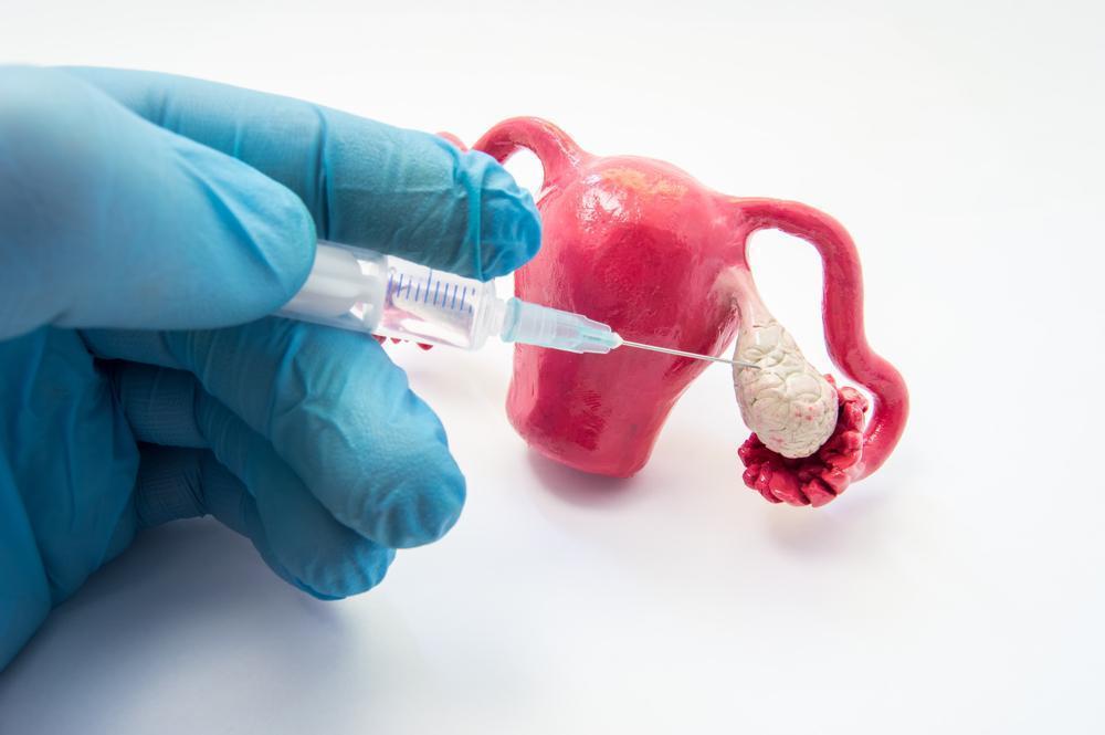 Advancements in Recurrent and Metastatic Cervical Cancer