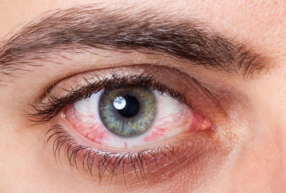 Uveitis in India and its changing patterns 