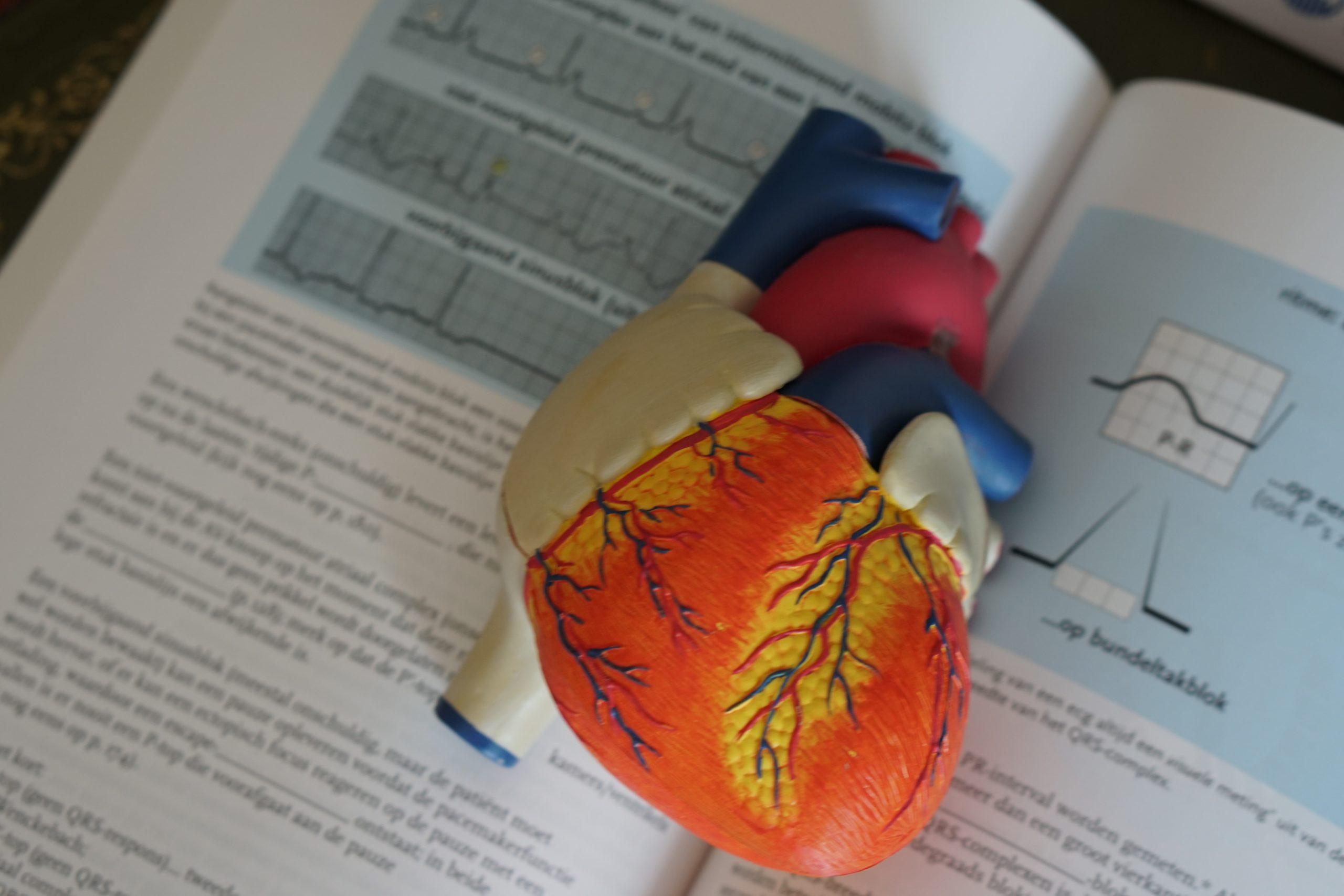 Prolong vs External ECG Monitoring on AF Detection