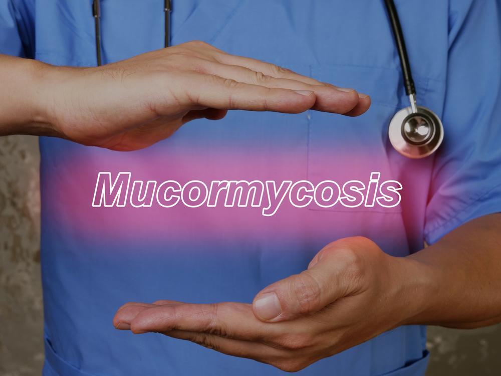 Mucormycosis after COVID 19 in a patient with diabetes