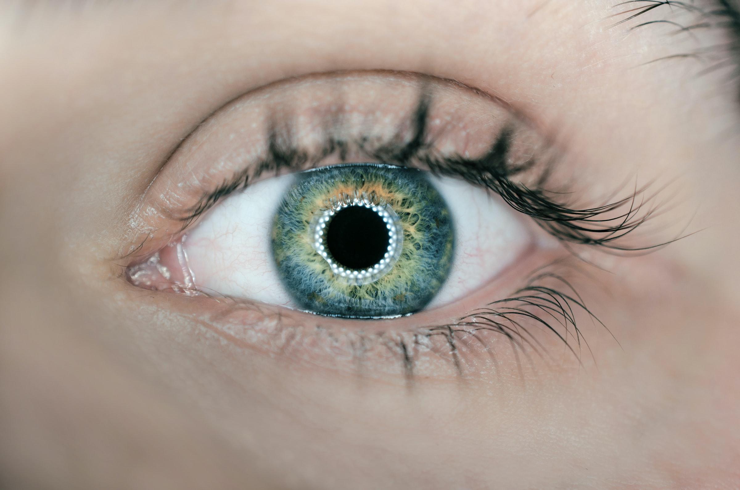 Ocular hypertension and glaucoma