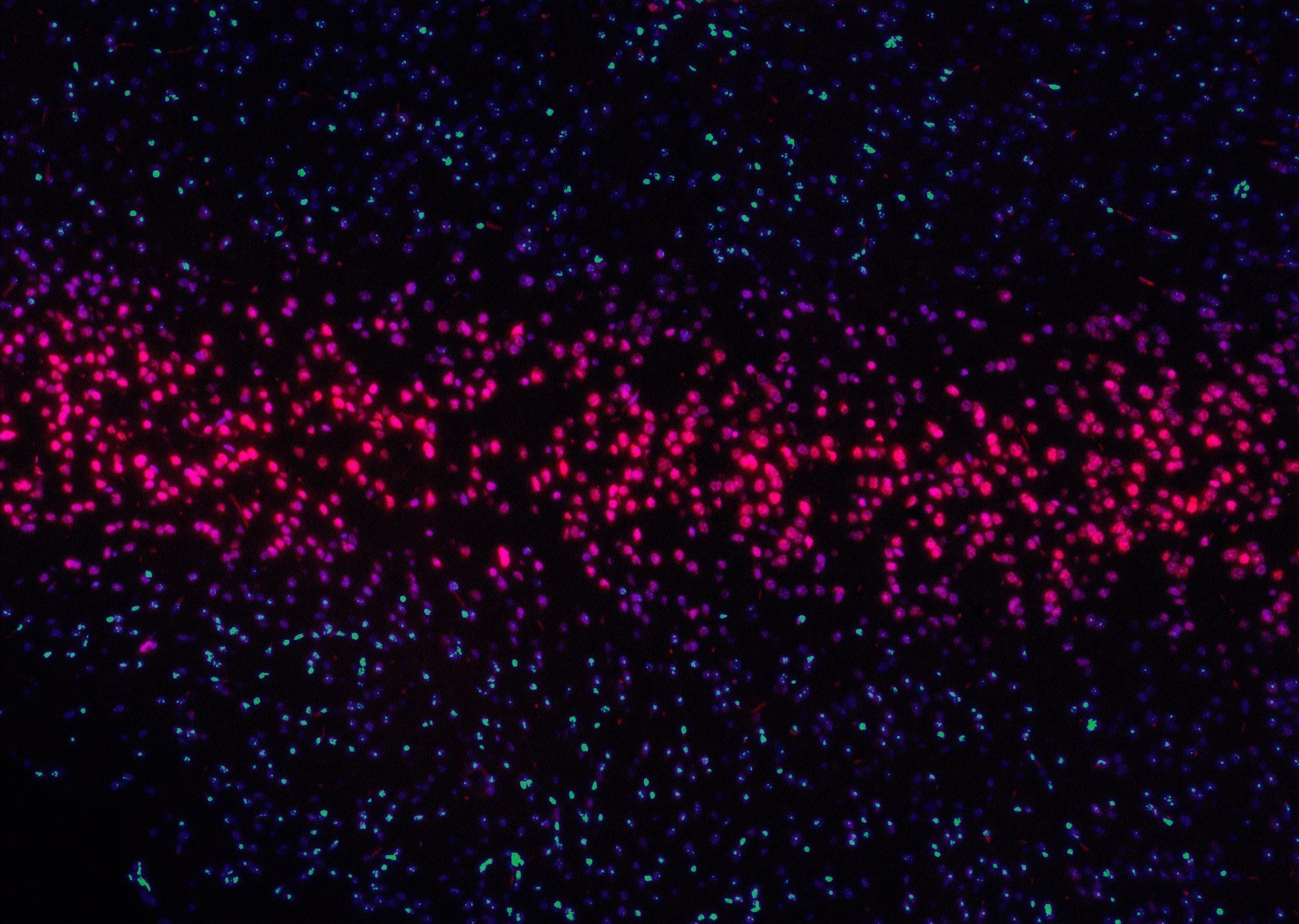 Biomarker testing decisions for lung cancer vary between academic