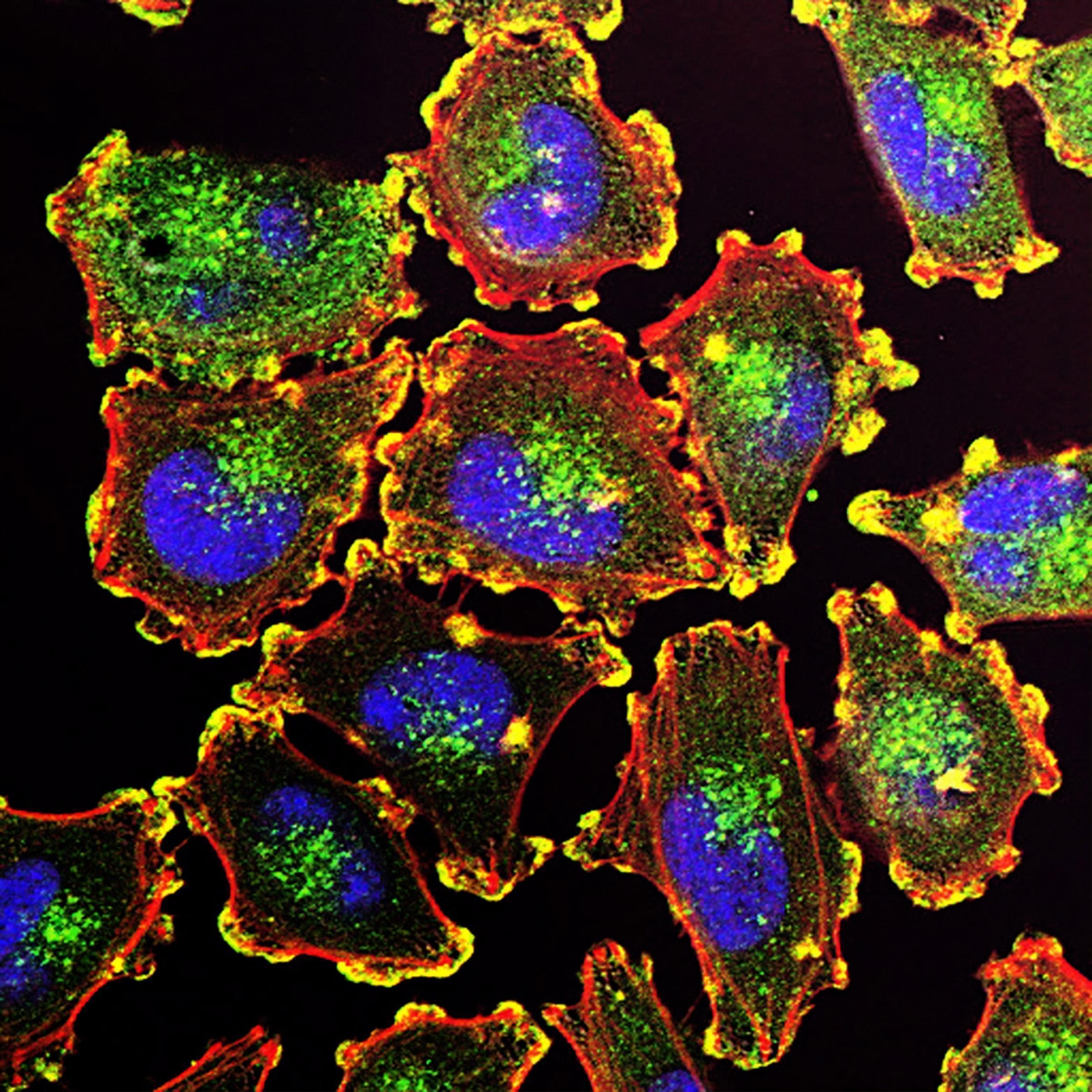 Revealing the colour of cancer cells