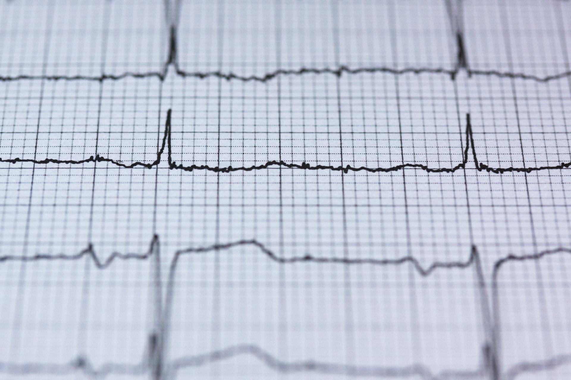 Socioeconomic barriers impact women’s cardiovascular health early in life