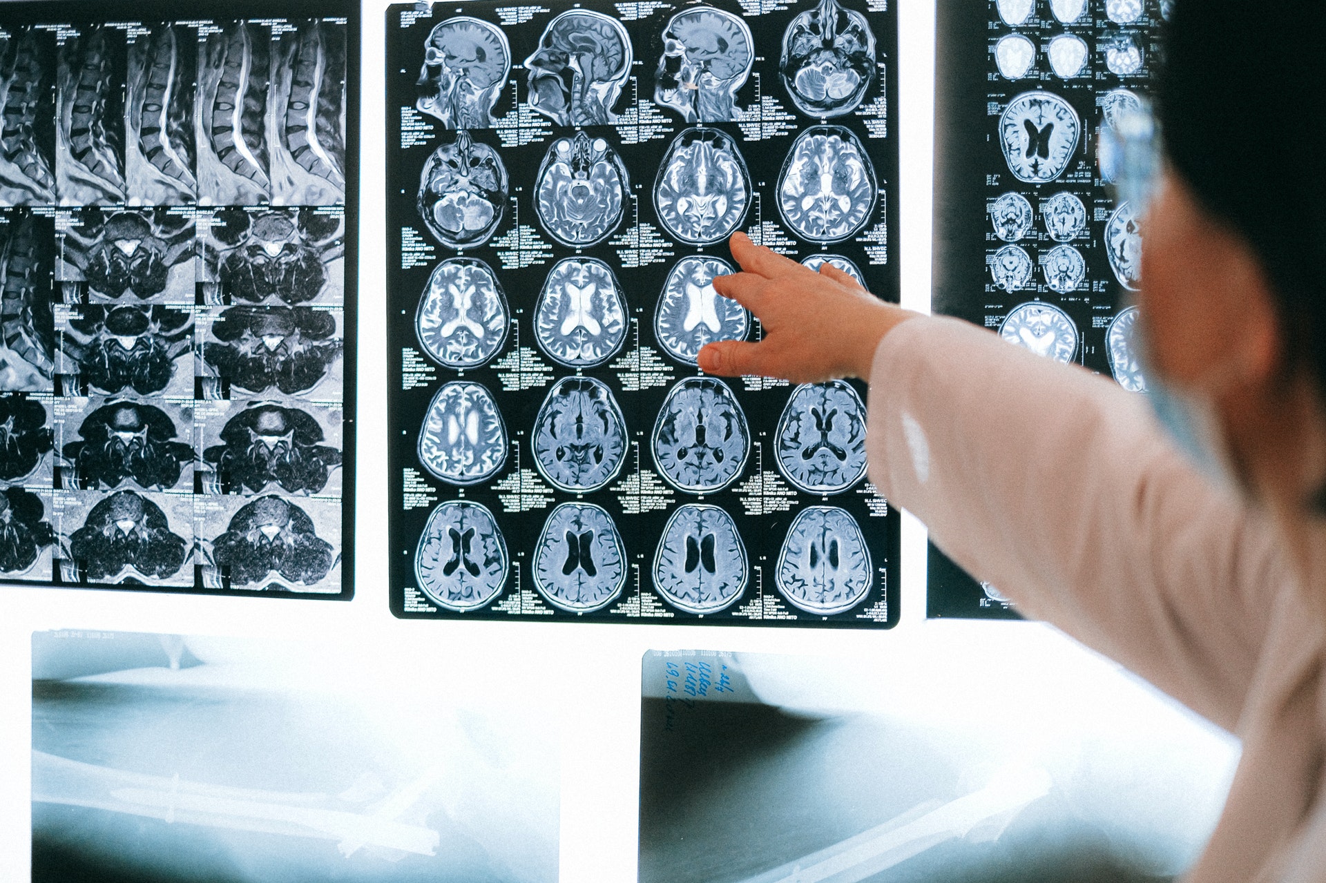 Holographic technology is helping doctors deliver better care