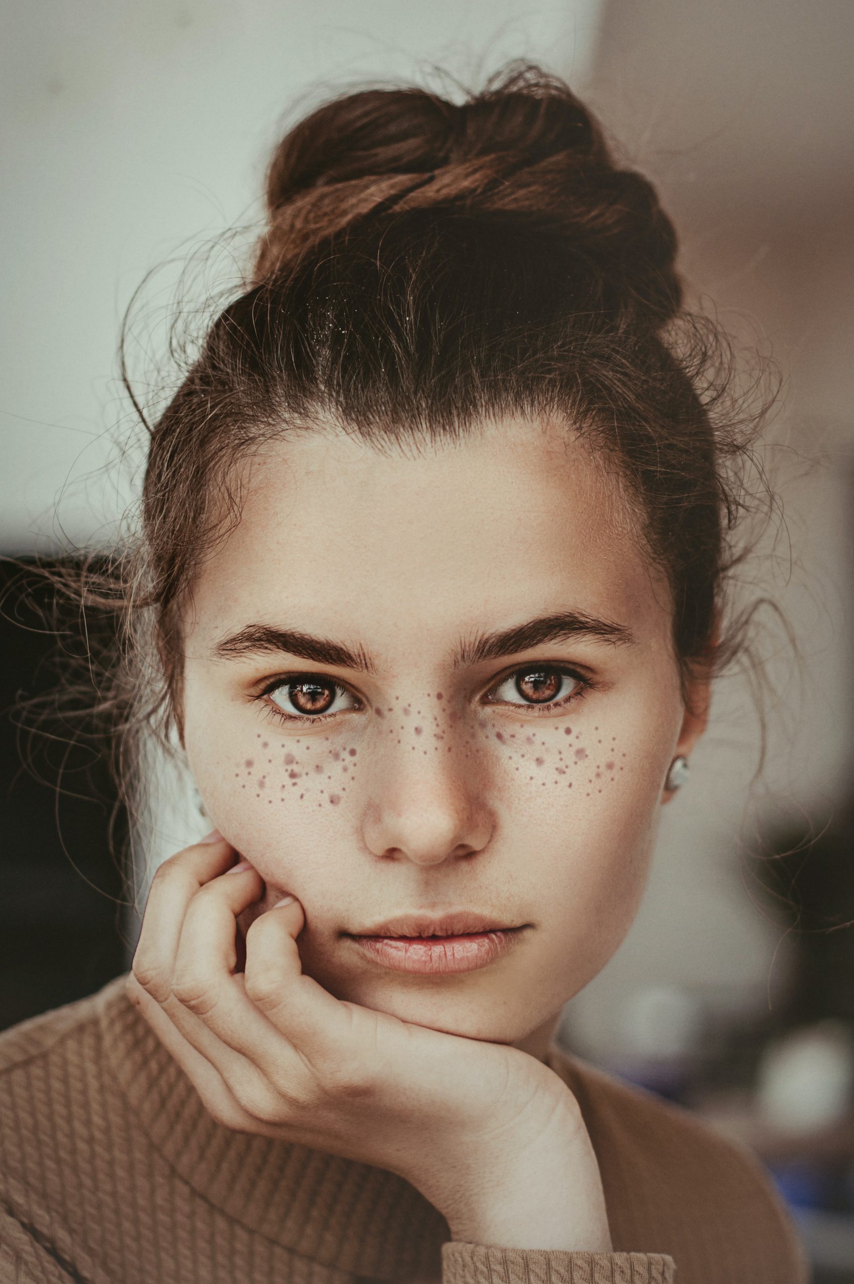 Effective melasma treatment: Microneedling with topical medication